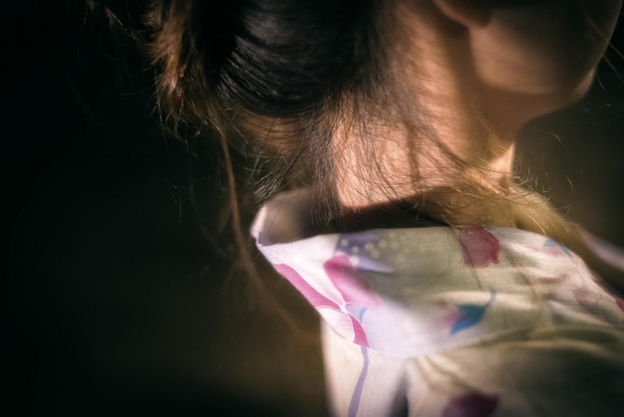 雪雪的颈部特写