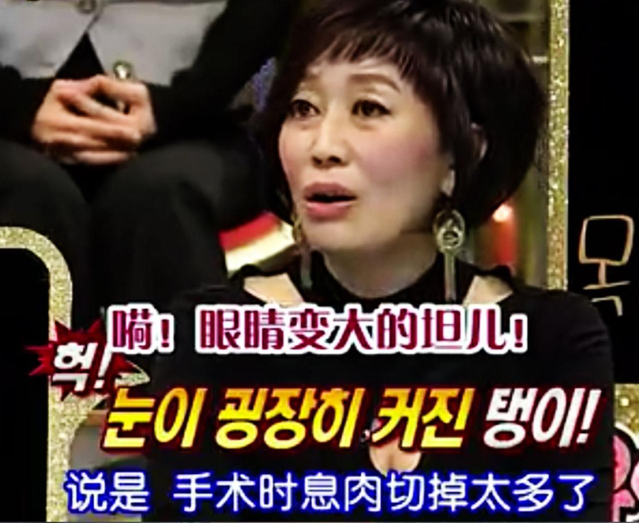 听到坦儿因为手术眼睛变大而吃惊的女嘉宾