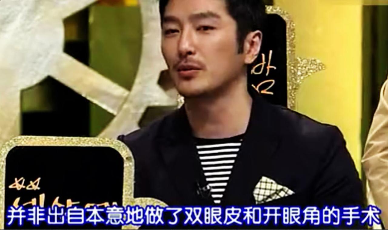 柳泰俊表示做双眼皮和开眼角手术并非本意